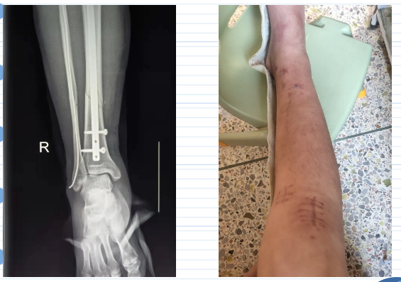 1636331013665991.png 微信截图_20211108082337.png